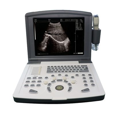 Draagbare volledige digitale diagnostische echografie-scanner OEM