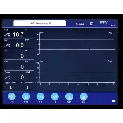 Portable Maquina DE Anestesia 10,4 Duimlcd de Machine van de het Schermanesthesie