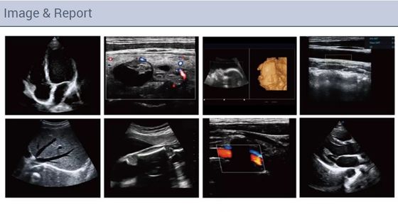 De cardiovasculaire van de Kleurendoppler van Cardiologie Draagbare Volledige Figital Machine van de de Ultrasone klankscanner