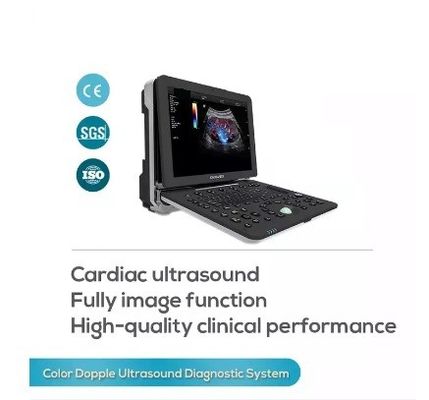 De cardiovasculaire van de Kleurendoppler van Cardiologie Draagbare Volledige Figital Machine van de de Ultrasone klankscanner