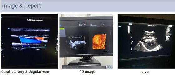 2D 3D 4D-Echocardiografie Hartkarretje Echo Color Doppler Ultrasound Machine