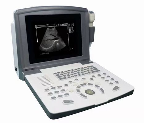 Draagbare volledige digitale diagnostische echografie-scanner OEM