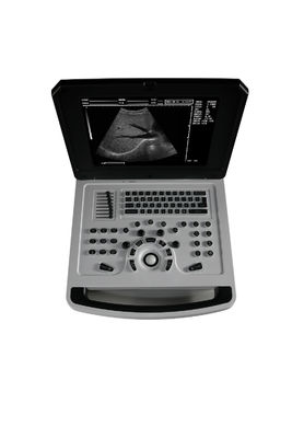 Notebook Zwarte en witte echografie voor cardiologie