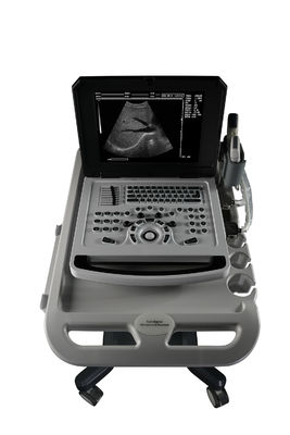 Notebook Zwarte en witte echografie voor cardiologie