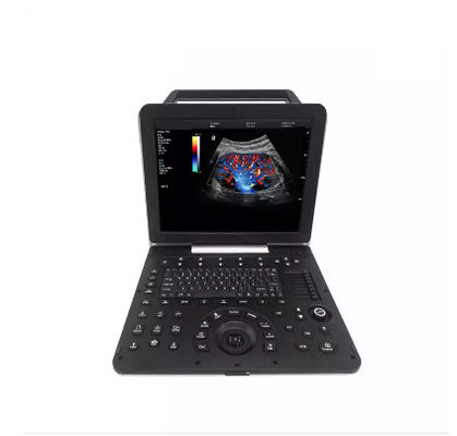 De cardiovasculaire van de Kleurendoppler van Cardiologie Draagbare Volledige Figital Machine van de de Ultrasone klankscanner